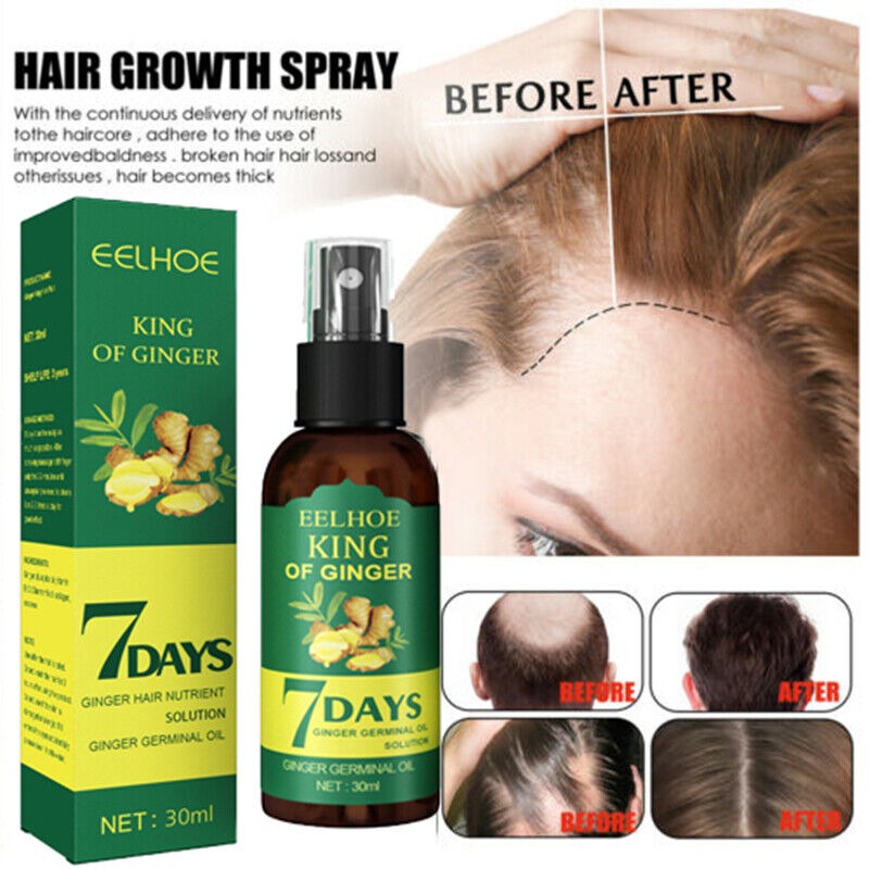 “7 Days Hair Growth Serum Oil – 30ML”